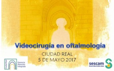 Video cirugía en oftalmología, Ciudad Real 2017